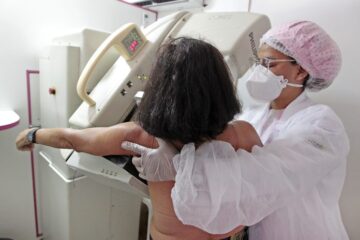 mamografia-696x464